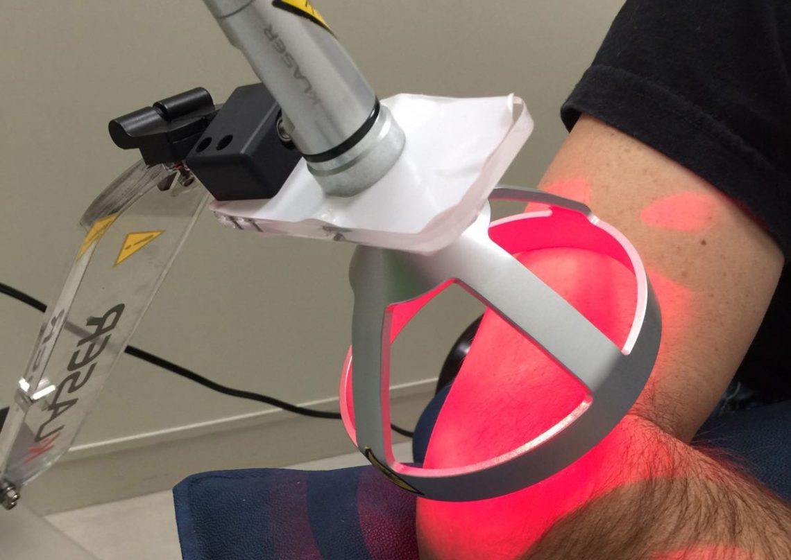 laser terapia viterbo